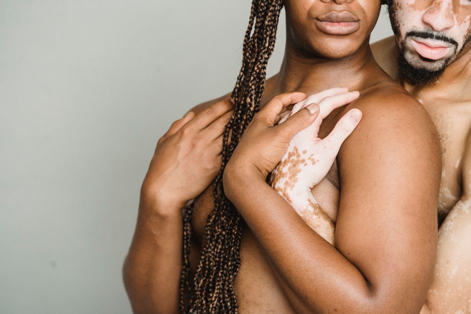 Crop shirtless man with vitiligo skin standing behind and hugging black shirtless boyfriend with long hair against gray wall during photo session in studio