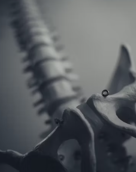 골다공증에 좋은 음식 10가지