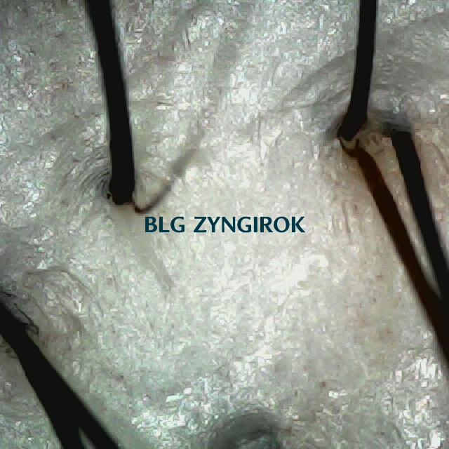 탈모 극복 프로젝트 - 뒷머리 두피 모습이다.