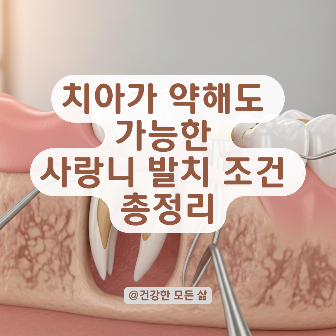 치아 상태가 안 좋아도 가능한 사랑니 발치, 치과의사가 말하는 조건들.