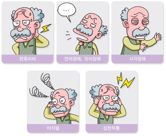 뇌졸중 전조증상