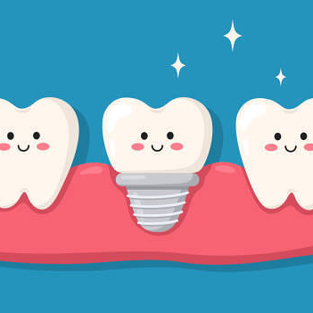 임플란트 의료보험적용대상