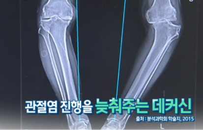 참당귀 데커신 효능