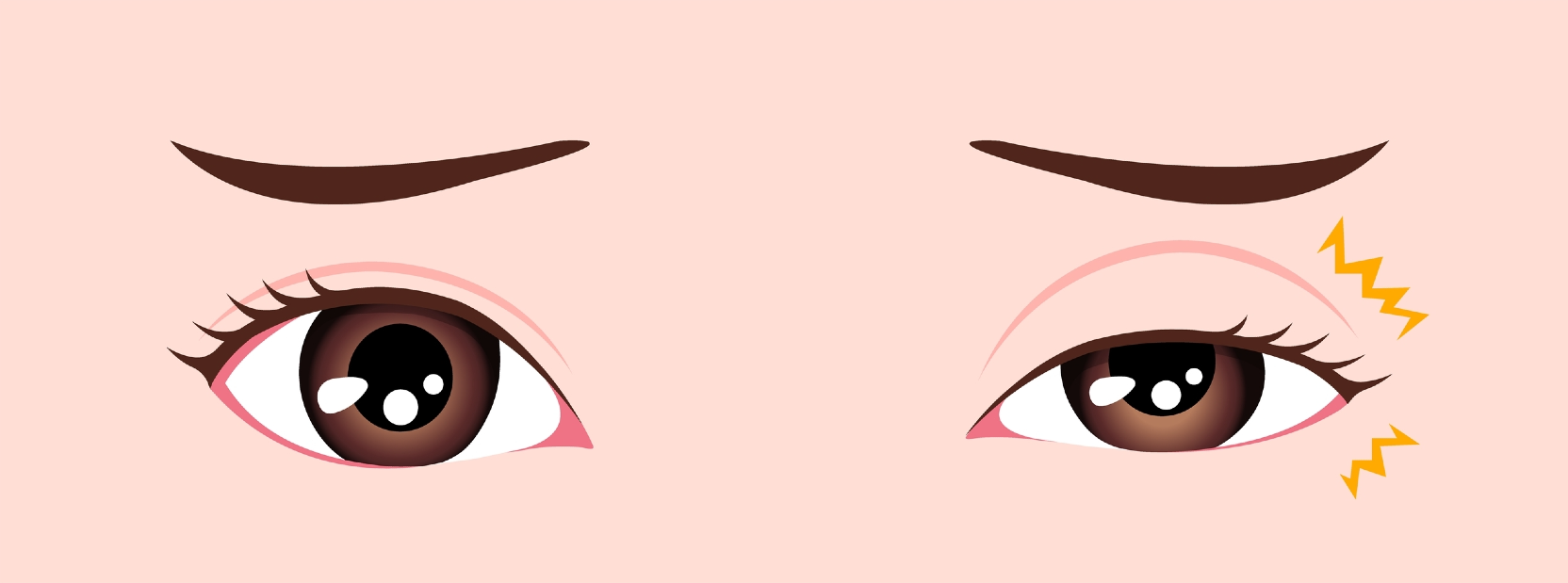 눈꺼풀떨림 눈떨림 왼쪽 오른쪽 원인 발생위치 멈추는 마사지 방법 