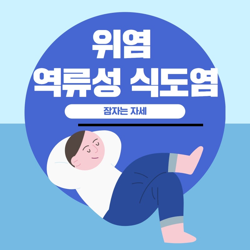 역류성 식도염 음식보다 중요한 생활 습관