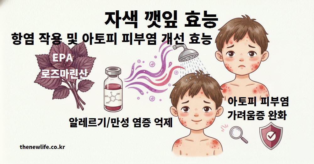 자색 깻잎 효능 항염 작용 및 아토피 피부염 완화