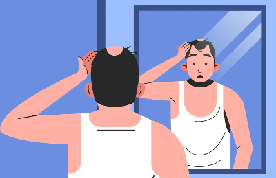 탈모 예방 및 치료