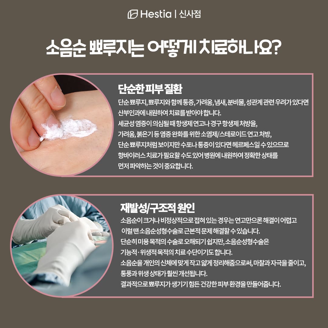 소음순뾰루지, 어떻게 치료할 수 있을까요?