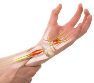 손목터널증후군 증상