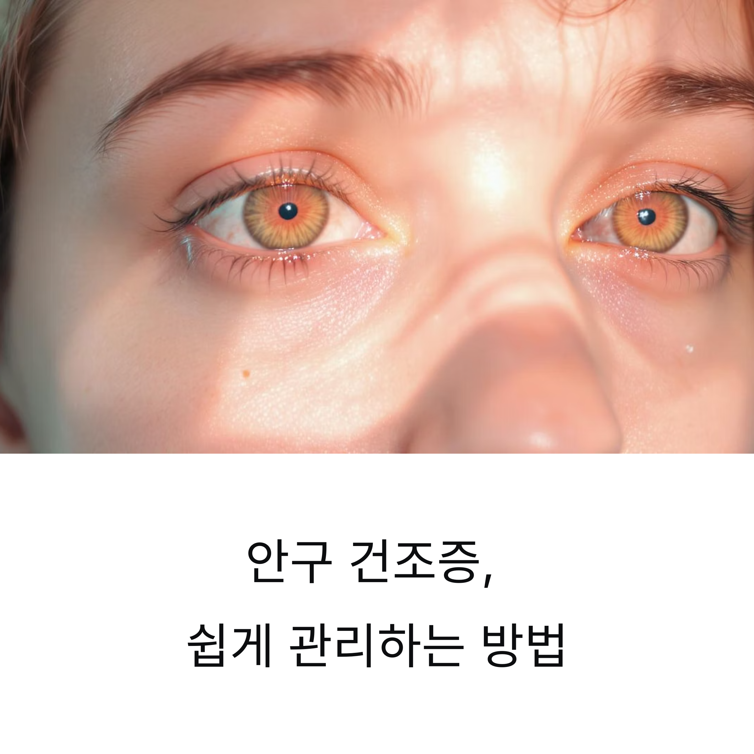 안구 건조증 관리 방법