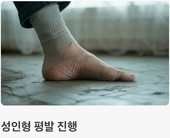 방치하면 '평발'이 심해질 수 있어요