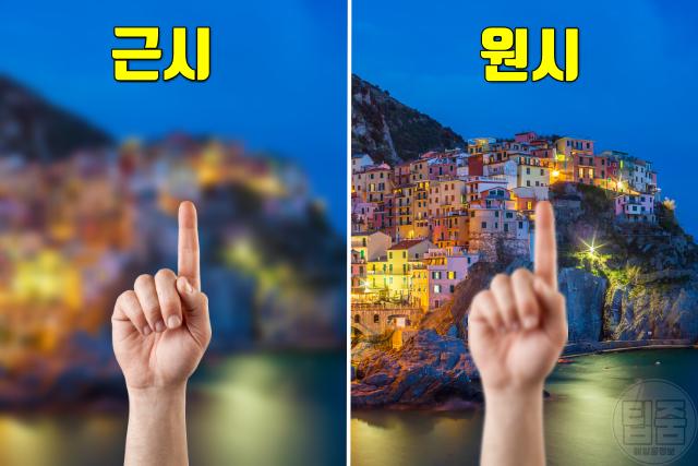 녹내장 잘 걸리는 사람 고위험군 특징 고도근시 고도원시