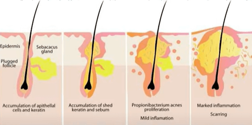 성장기 대표 트러블