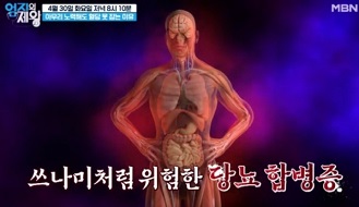 당뇨합병증