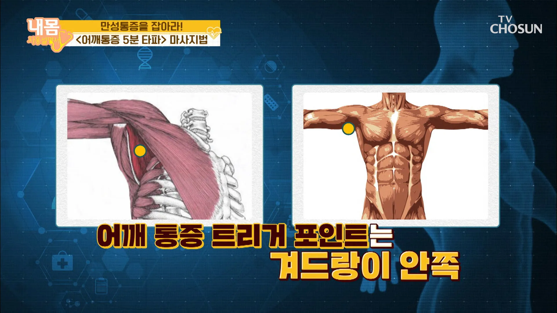 겨드랑이 통증