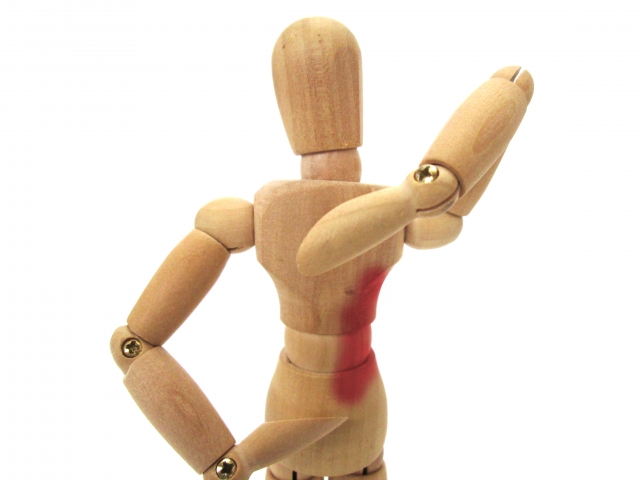 대상포진-모형-부위