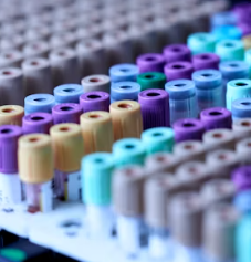 만성 방광염 치료 방법 진단 기준 합병증