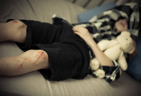 teen self harm coping