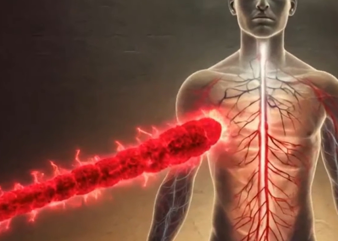 에이즈 초기증상