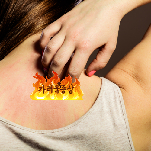 옴의 원인과 증상