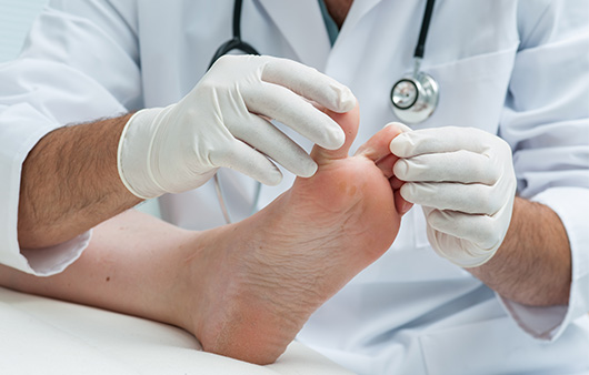 백선(trichophytia)