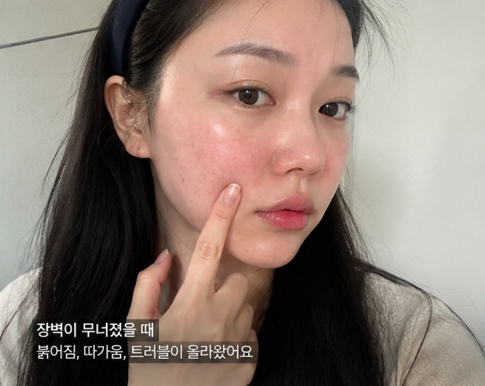 피부 장벽 자극 및 손상 시 나타나는 대표적인 증상 7가지 체크리스트