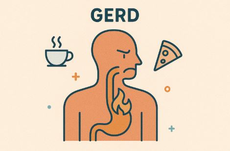 역류성 식도염 약물치료 가이드 관련 사진