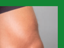 관절에좋은음식