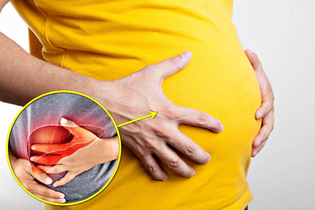 뱃살 복수 부종 붓기 간이 안좋을때 증상, 건강 팁줌 매일꿀정보