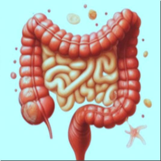 과민성대장증후군 가스형 예방과 치료, 장 이미지