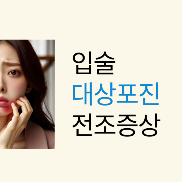 대상포진