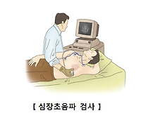 심근경색 전조증상