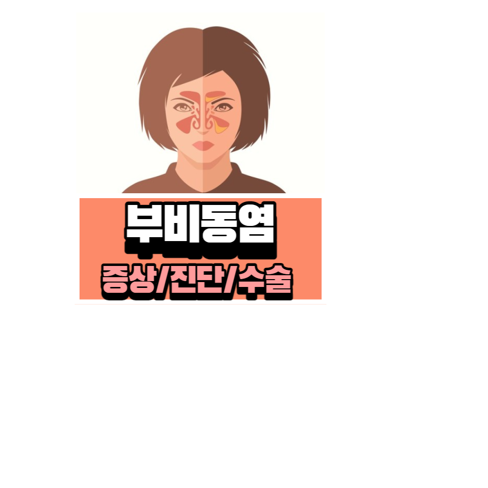 부비동염