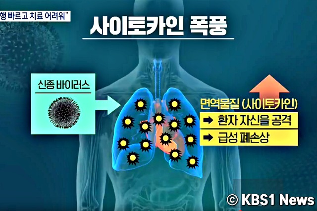 코로나 증상,우한 폐렴 증상,건강