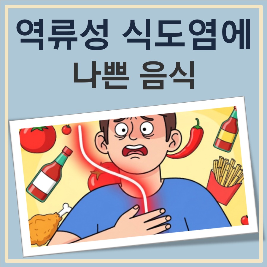 역류성식도염에 나쁜 음식(