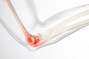 고관절-통증-원인