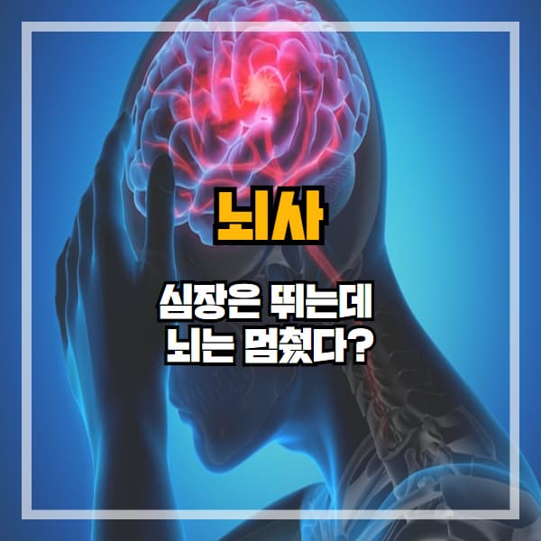 심장은 뛰는데 뇌는 멈췄다? 뇌사란 무엇인가요