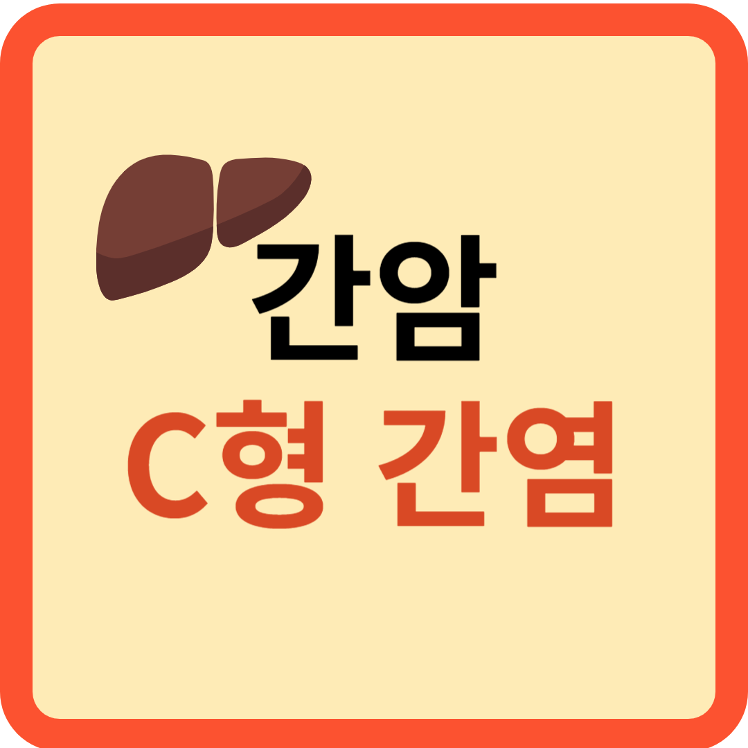 간암 C형 간염과의 상관관계