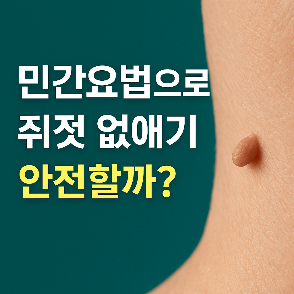 민간요법으로 쥐젖 없애기, 효과와 안전성 전격 비교