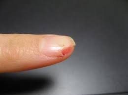 손톱에 세로줄이 생기는 이유