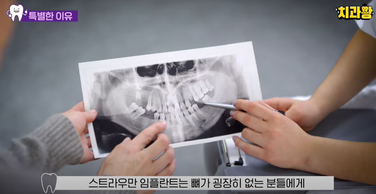 뼈가 굉장히 없는 분들께에도 효과적입니다.