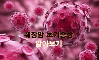 췌장암 초기증상과 진단 지연의 원인 &ndash; 왜 침묵의 암인가