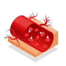 나쁜콜레스테롤 낮추는 방법