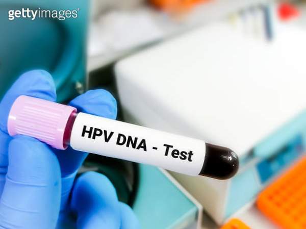 hpv 바이러스 원인