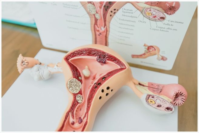 자궁경부 이형성증