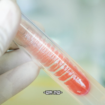 혈뇨가 나오는 이유