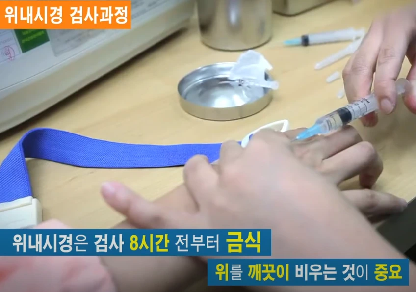 위내시경 금식시간