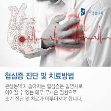 협심증 치료 방법