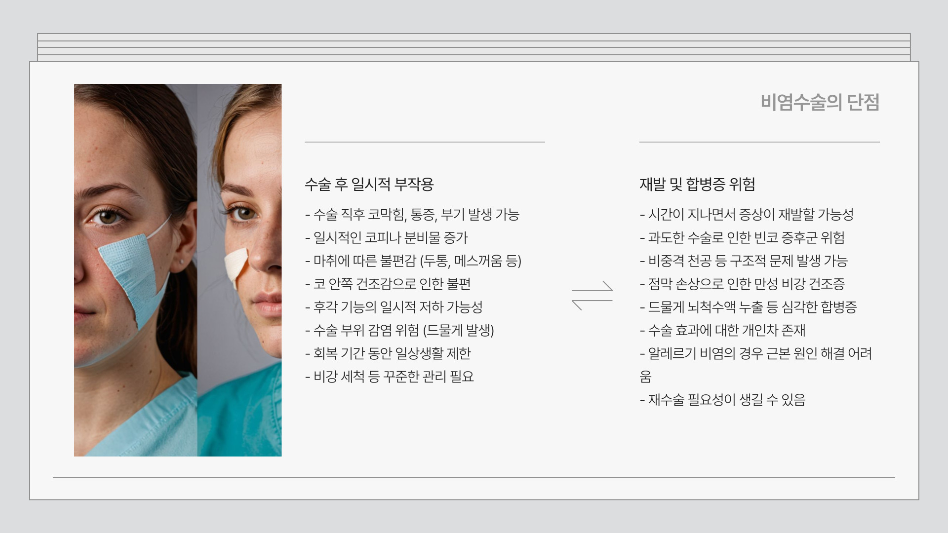 비염수술