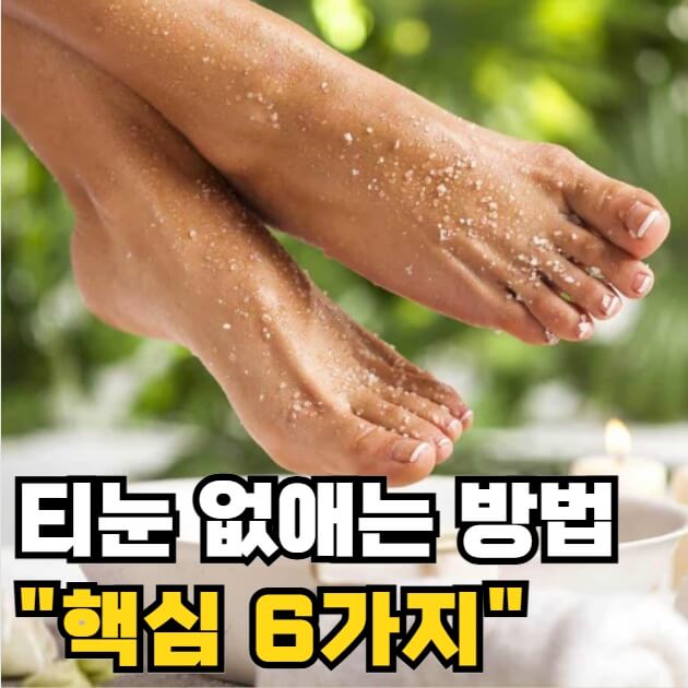 티눈 없애는 방법